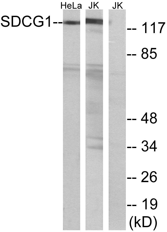 NY-CO-1 Rabbit Polyclonal Antibody