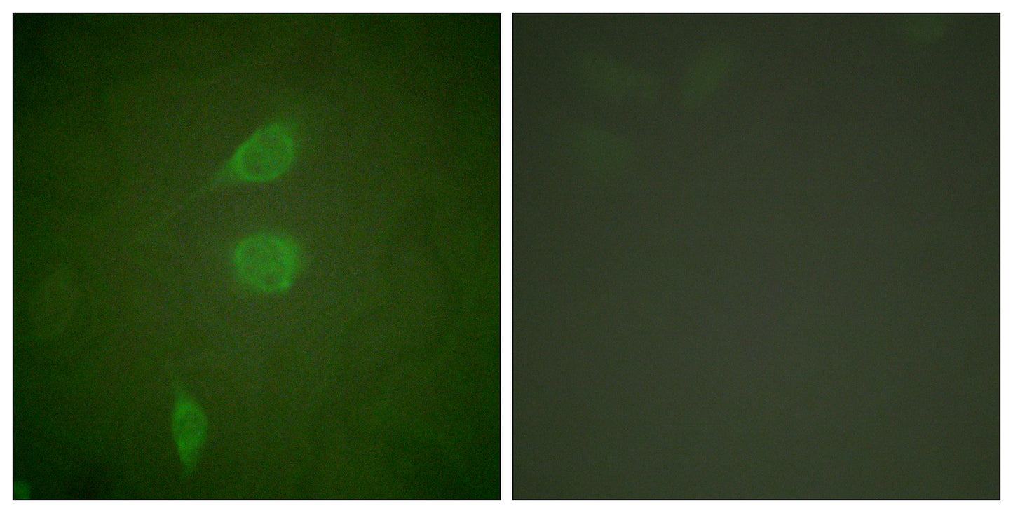 NY-CO-9 Rabbit Polyclonal Antibody