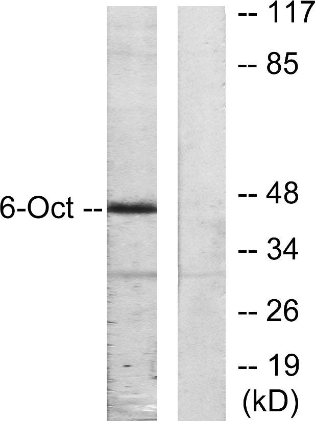 Oct-6 Rabbit Polyclonal Antibody