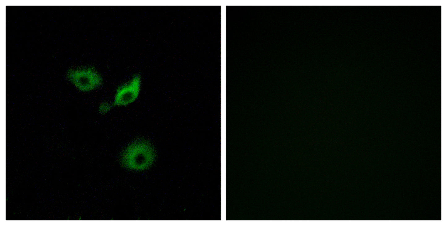 Olfactory receptor 10AD1 Rabbit Polyclonal Antibody