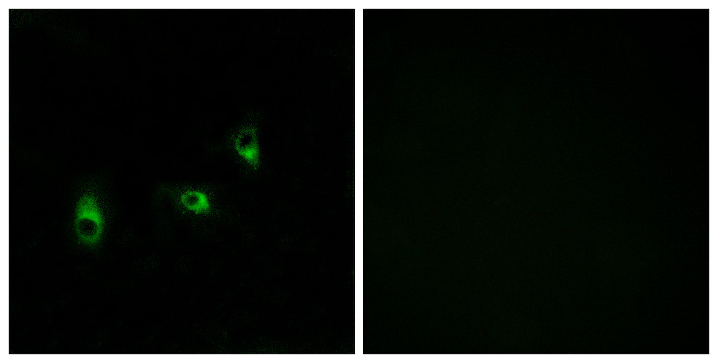 Olfactory receptor 10G2 Rabbit Polyclonal Antibody