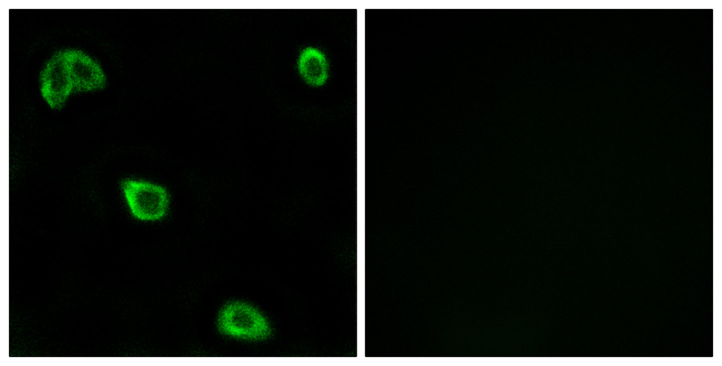 Olfactory receptor 10K1/2 Rabbit Polyclonal Antibody
