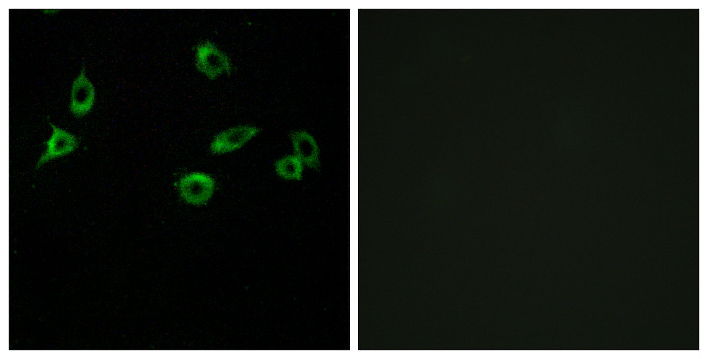 Olfactory receptor 10S1 Rabbit Polyclonal Antibody