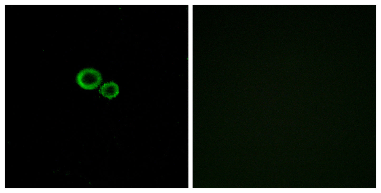 Olfactory receptor 11G2 Rabbit Polyclonal Antibody