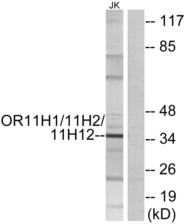 Olfactory receptor 11H1/11H2/11H12 Rabbit Polyclonal Antibody