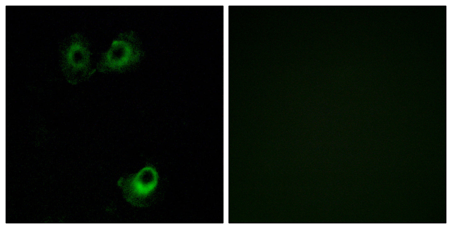 Olfactory receptor 11L1 Rabbit Polyclonal Antibody
