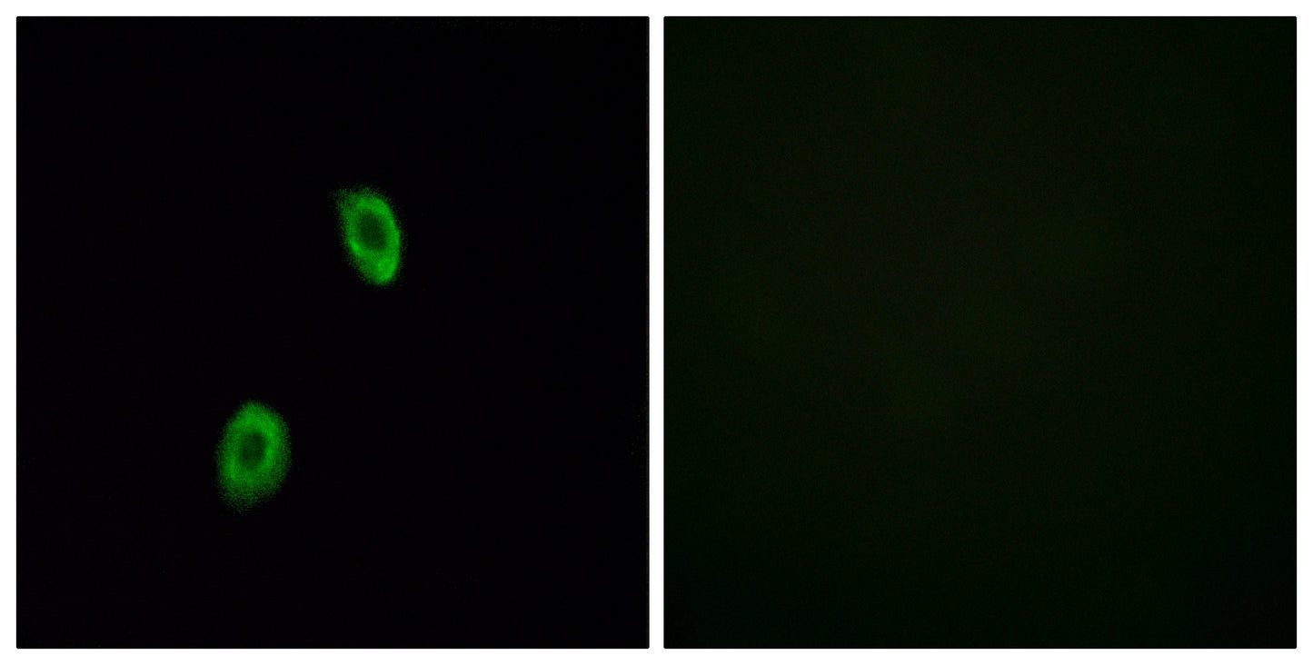 Olfactory receptor 1D2 Rabbit Polyclonal Antibody