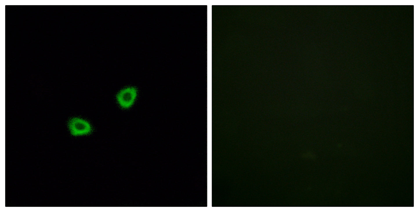 Olfactory receptor 1L6 Rabbit Polyclonal Antibody