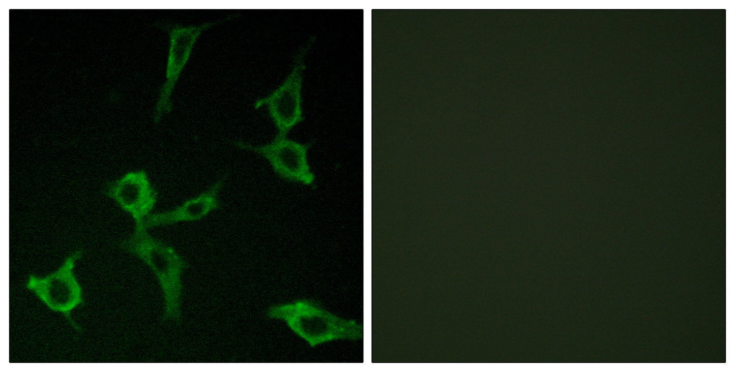 Olfactory receptor 2AG1/2 Rabbit Polyclonal Antibody