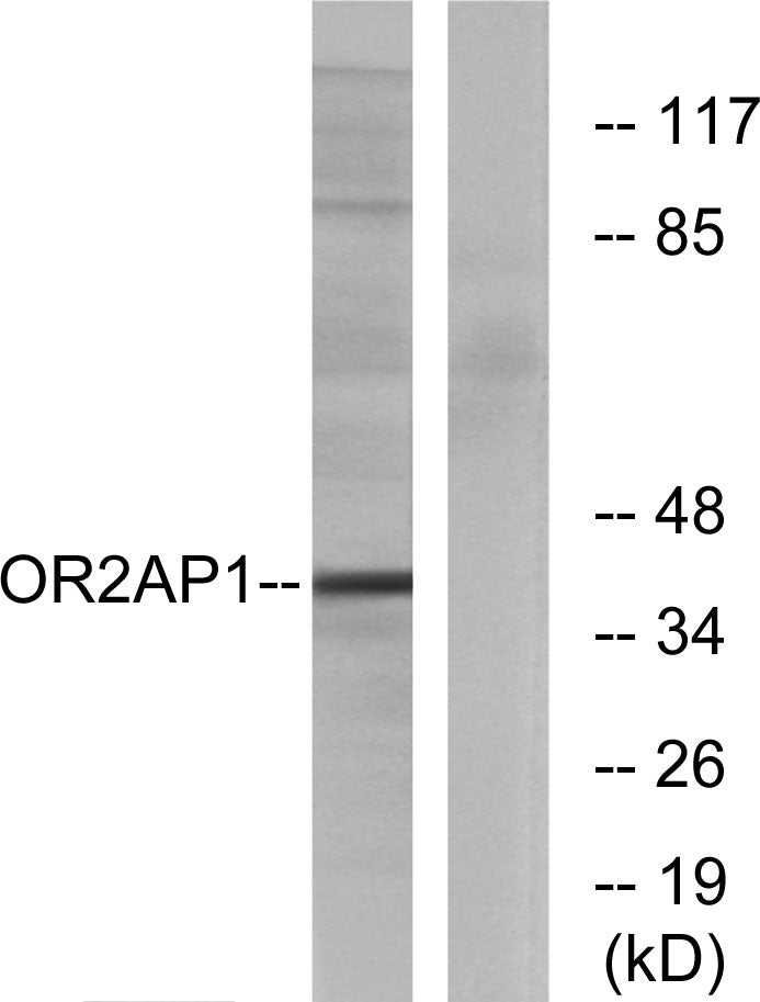 Olfactory receptor 2AP1 Rabbit Polyclonal Antibody