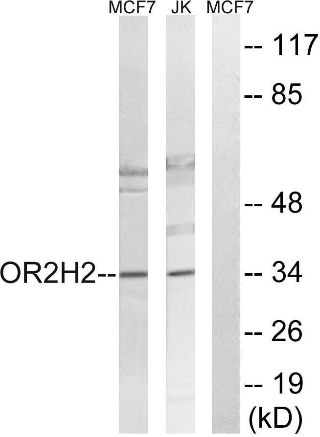 Olfactory receptor 2H2 Rabbit Polyclonal Antibody