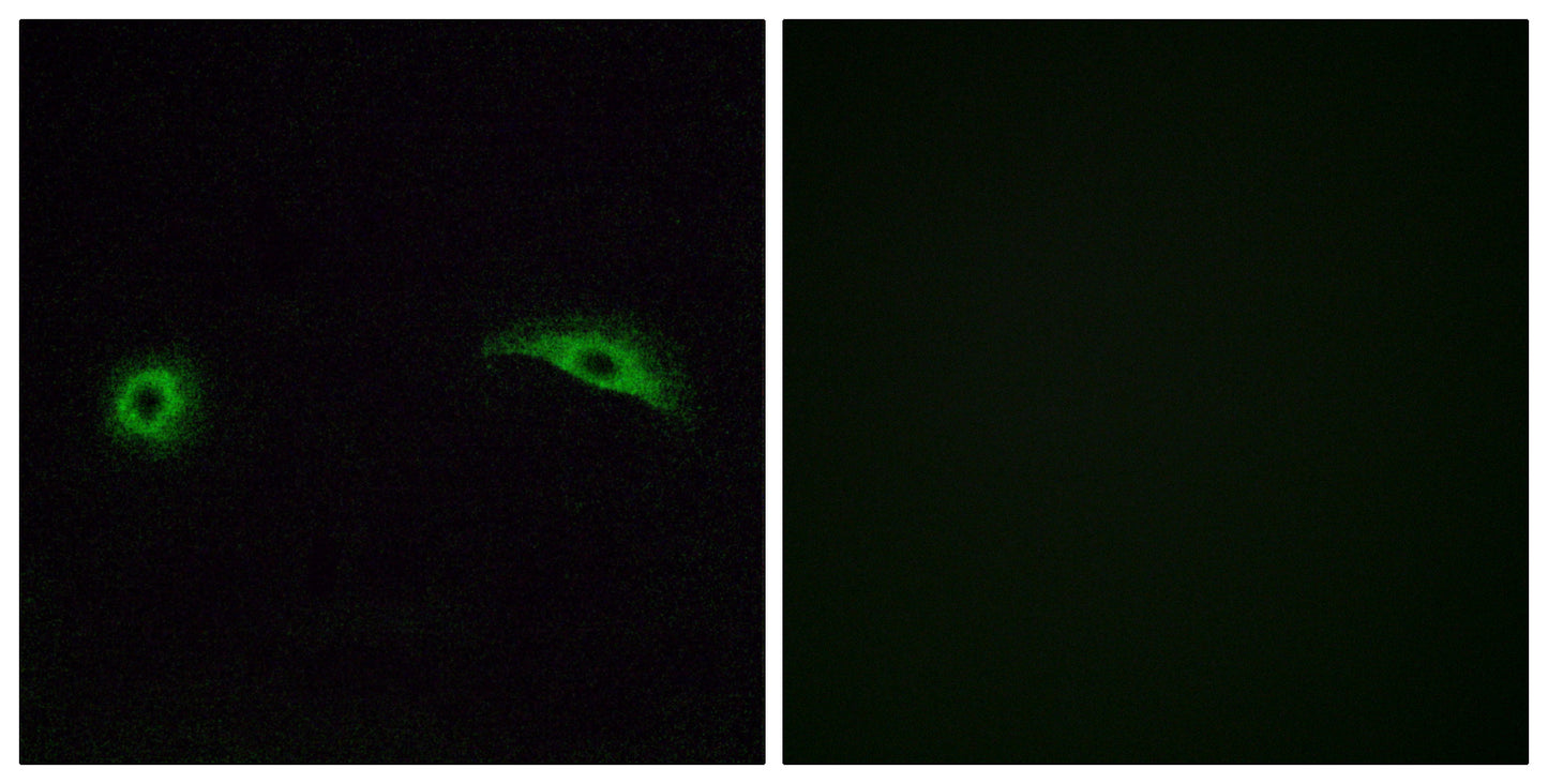 Olfactory receptor 2J2 Rabbit Polyclonal Antibody