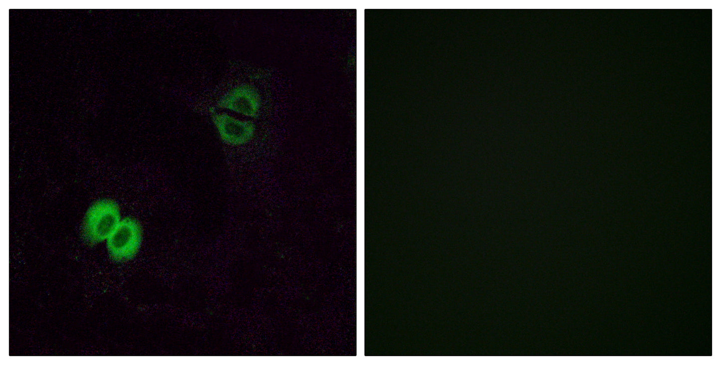 Olfactory receptor 2T1 Rabbit Polyclonal Antibody