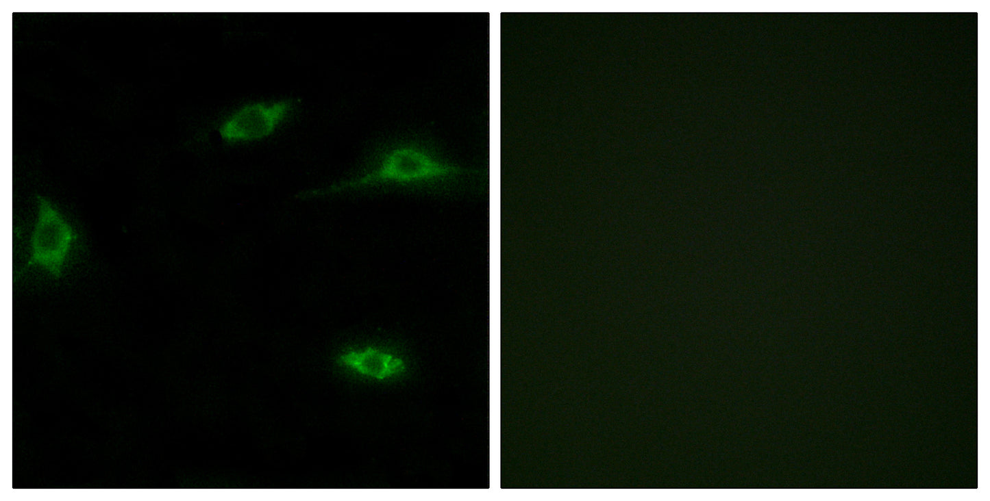 Olfactory receptor 2T11 Rabbit Polyclonal Antibody