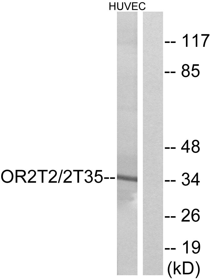 Olfactory receptor 2T2/35 Rabbit Polyclonal Antibody