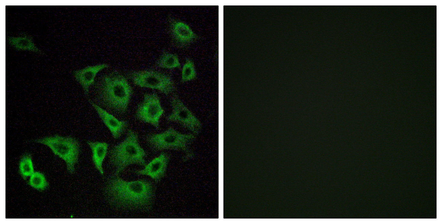 Olfactory receptor 4K14 Rabbit Polyclonal Antibody