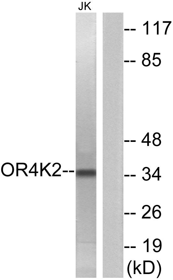 Olfactory receptor 4K2 Rabbit Polyclonal Antibody