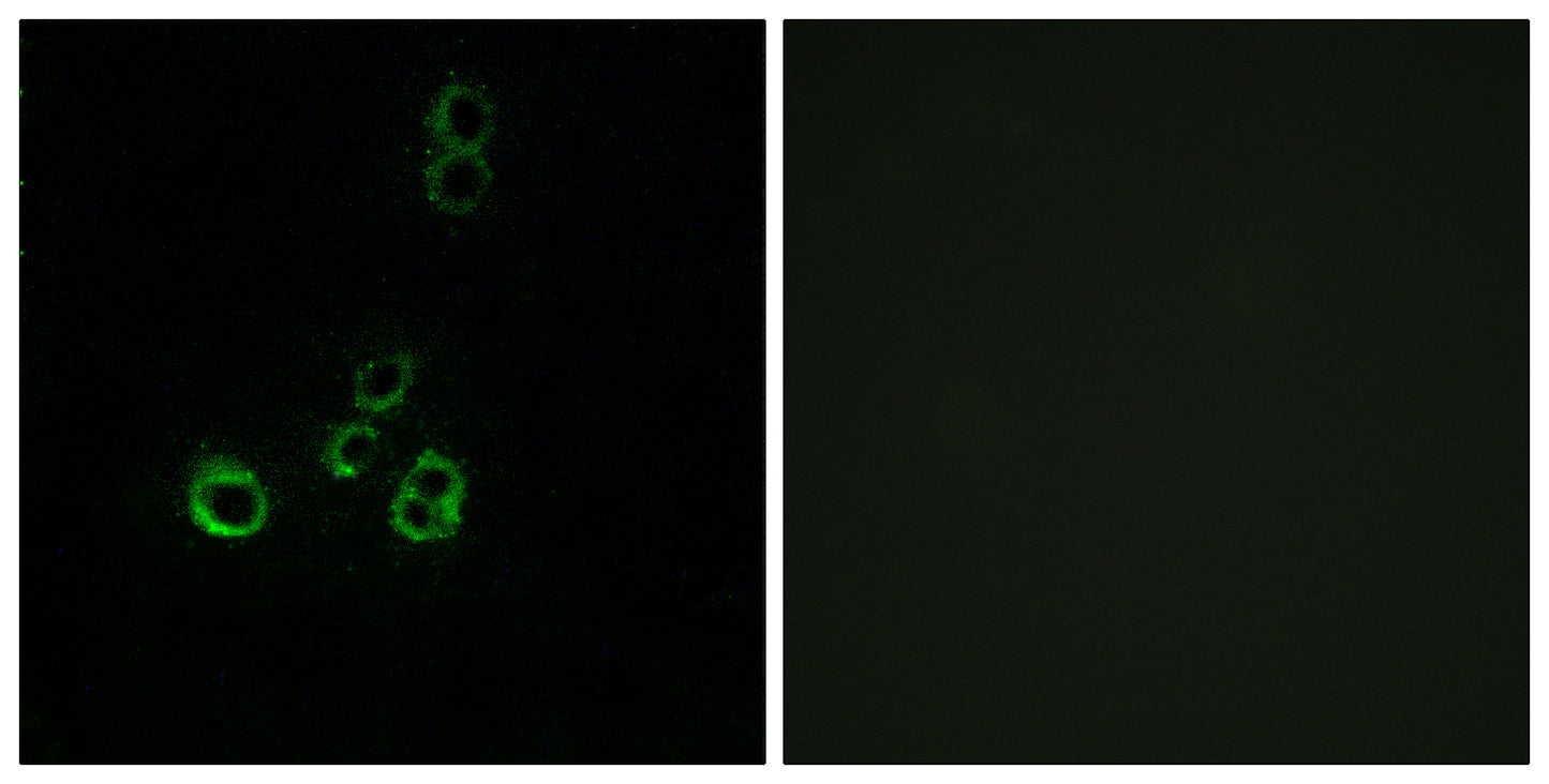 Olfactory receptor 51F2 Rabbit Polyclonal Antibody