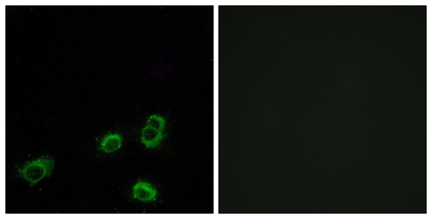 Olfactory receptor 52A1 Rabbit Polyclonal Antibody