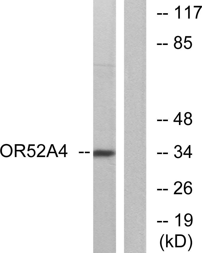 Olfactory receptor 52A4 Rabbit Polyclonal Antibody