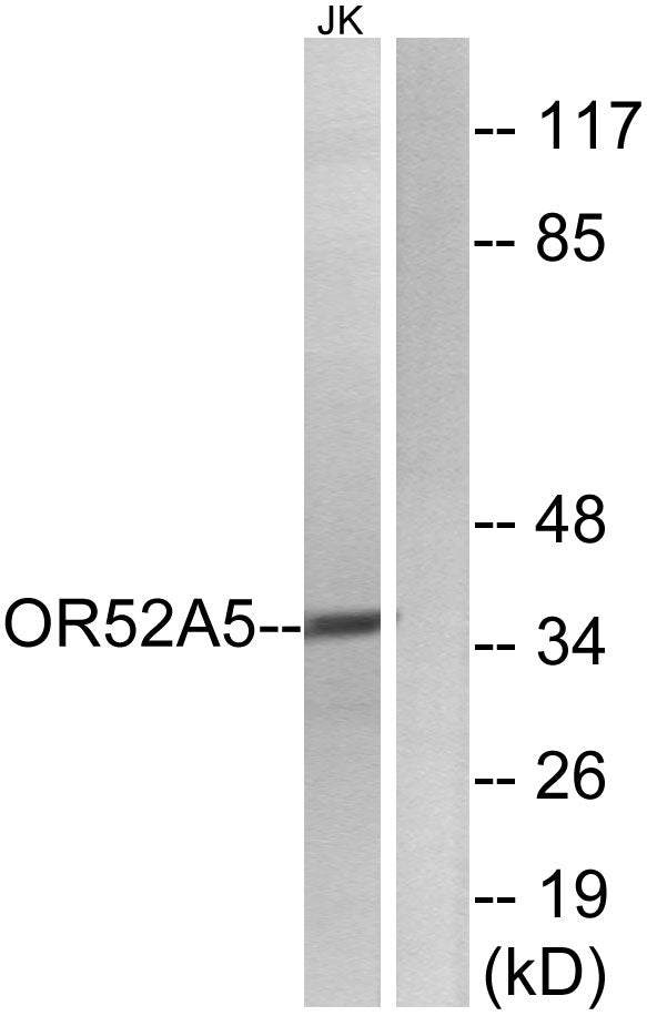 Olfactory receptor 52A5 Rabbit Polyclonal Antibody