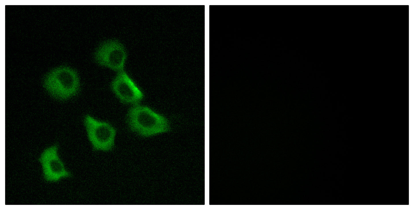 Olfactory receptor 52B2 Rabbit Polyclonal Antibody