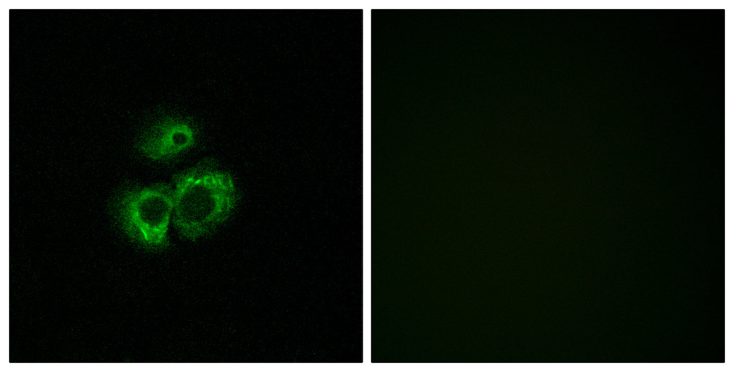 Olfactory receptor 52D1 Rabbit Polyclonal Antibody