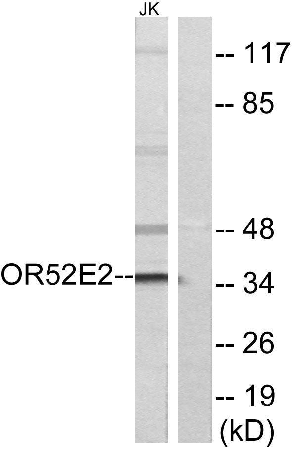 Olfactory receptor 52E2 Rabbit Polyclonal Antibody