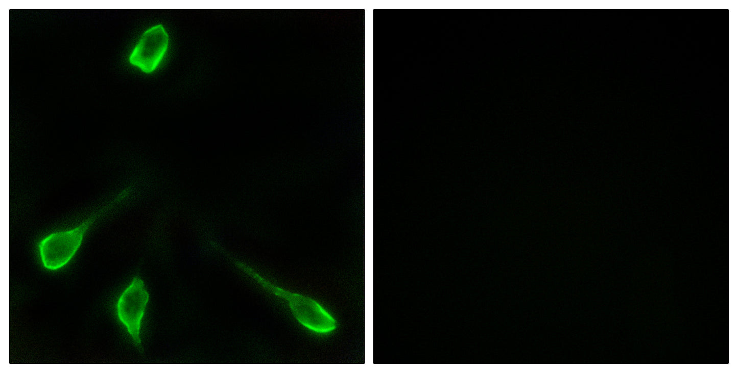Olfactory receptor 52E4 Rabbit Polyclonal Antibody
