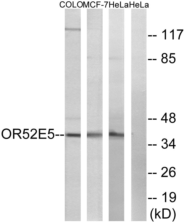 Olfactory receptor 52E5 Rabbit Polyclonal Antibody