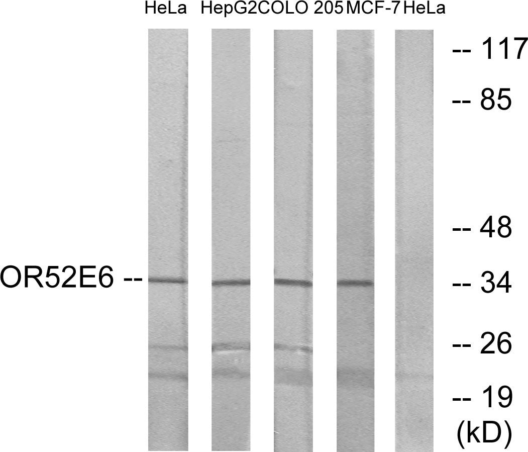 Olfactory receptor 52E6 Rabbit Polyclonal Antibody