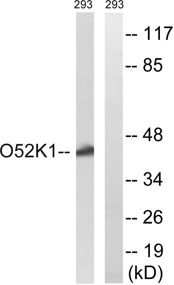 Olfactory receptor 52K1 Rabbit Polyclonal Antibody
