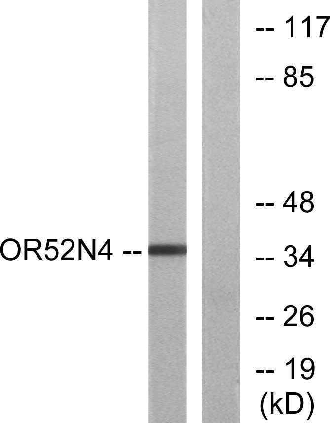 Olfactory receptor 52N4 Rabbit Polyclonal Antibody