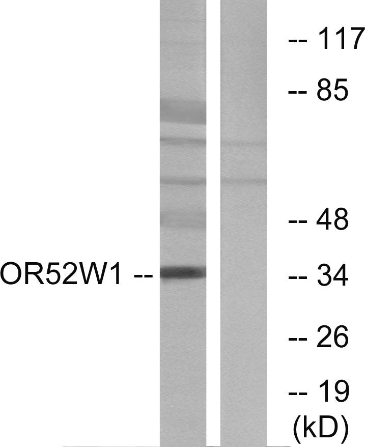 Olfactory receptor 52W1 Rabbit Polyclonal Antibody