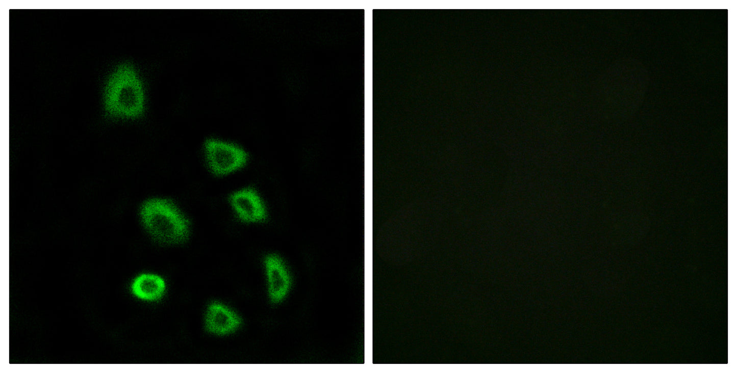 Olfactory receptor 5K1 Rabbit Polyclonal Antibody