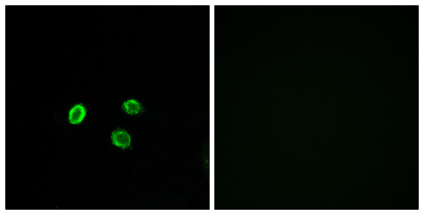 Olfactory receptor 5M9 Rabbit Polyclonal Antibody