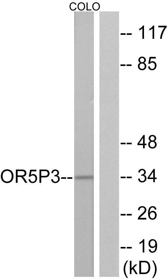 Olfactory receptor 5P3 Rabbit Polyclonal Antibody