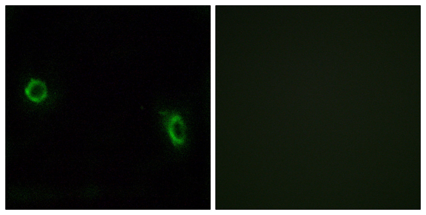 Olfactory receptor 6J1 Rabbit Polyclonal Antibody