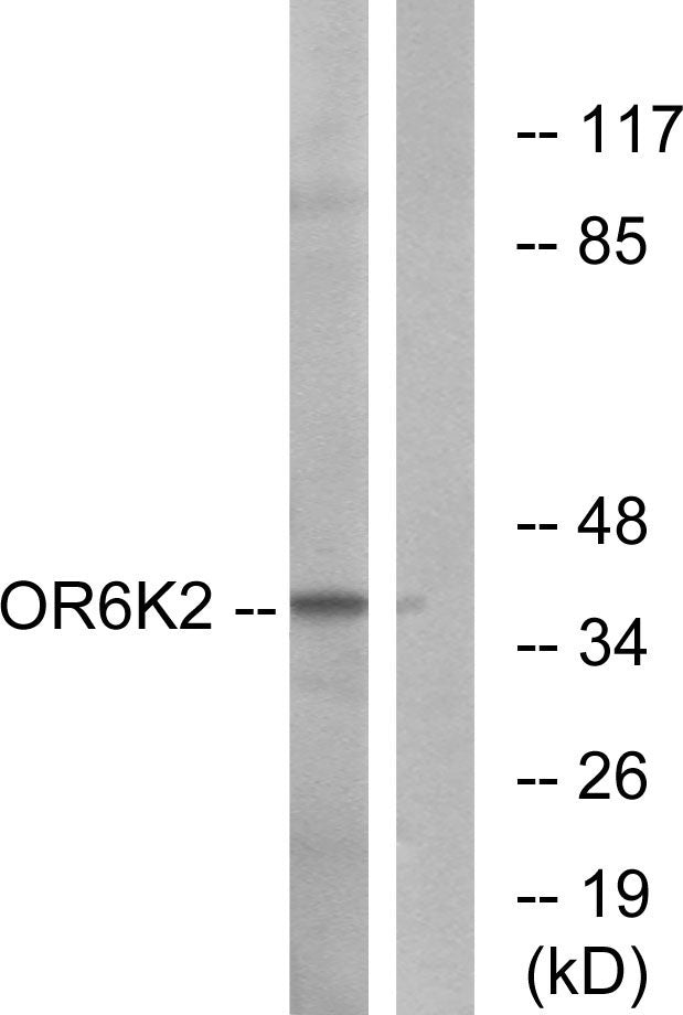 Olfactory receptor 6K2 Rabbit Polyclonal Antibody