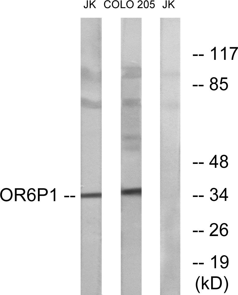 Olfactory receptor 6P1 Rabbit Polyclonal Antibody