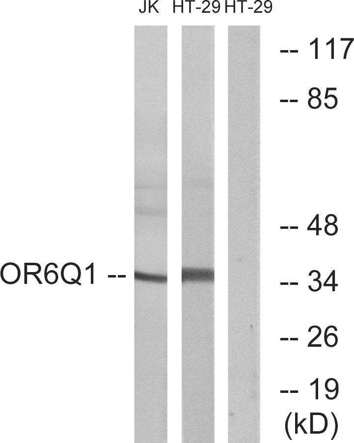 Olfactory receptor 6Q1 Rabbit Polyclonal Antibody