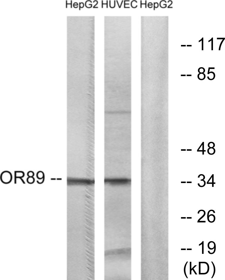 Olfactory receptor 89 Rabbit Polyclonal Antibody
