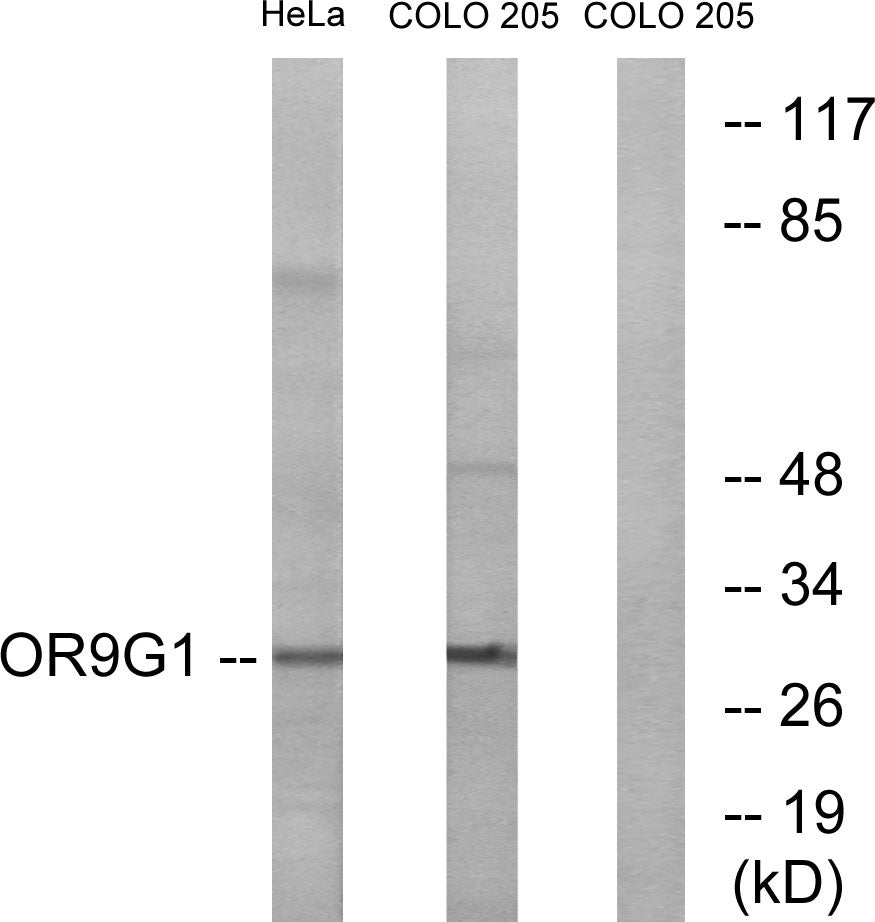 Olfactory receptor 9G1 Rabbit Polyclonal Antibody