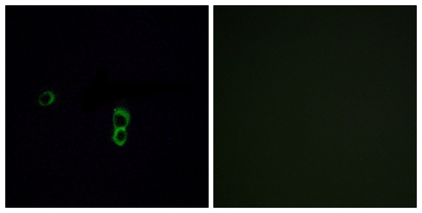 Olfactory receptor 9Q1 Rabbit Polyclonal Antibody