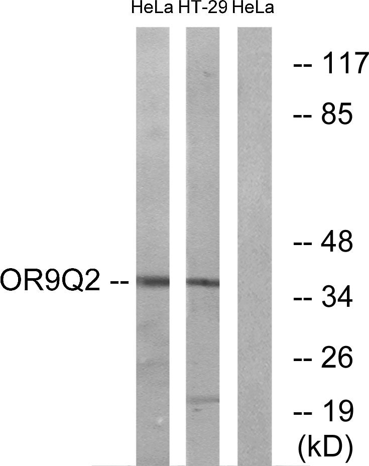 Olfactory receptor 9Q2 Rabbit Polyclonal Antibody