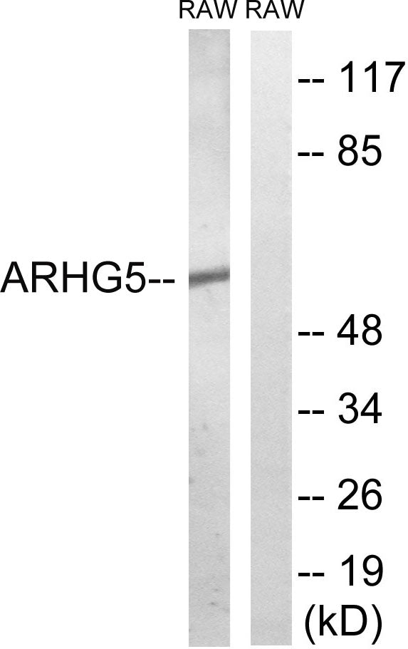 Oncogene TIM Rabbit Polyclonal Antibody