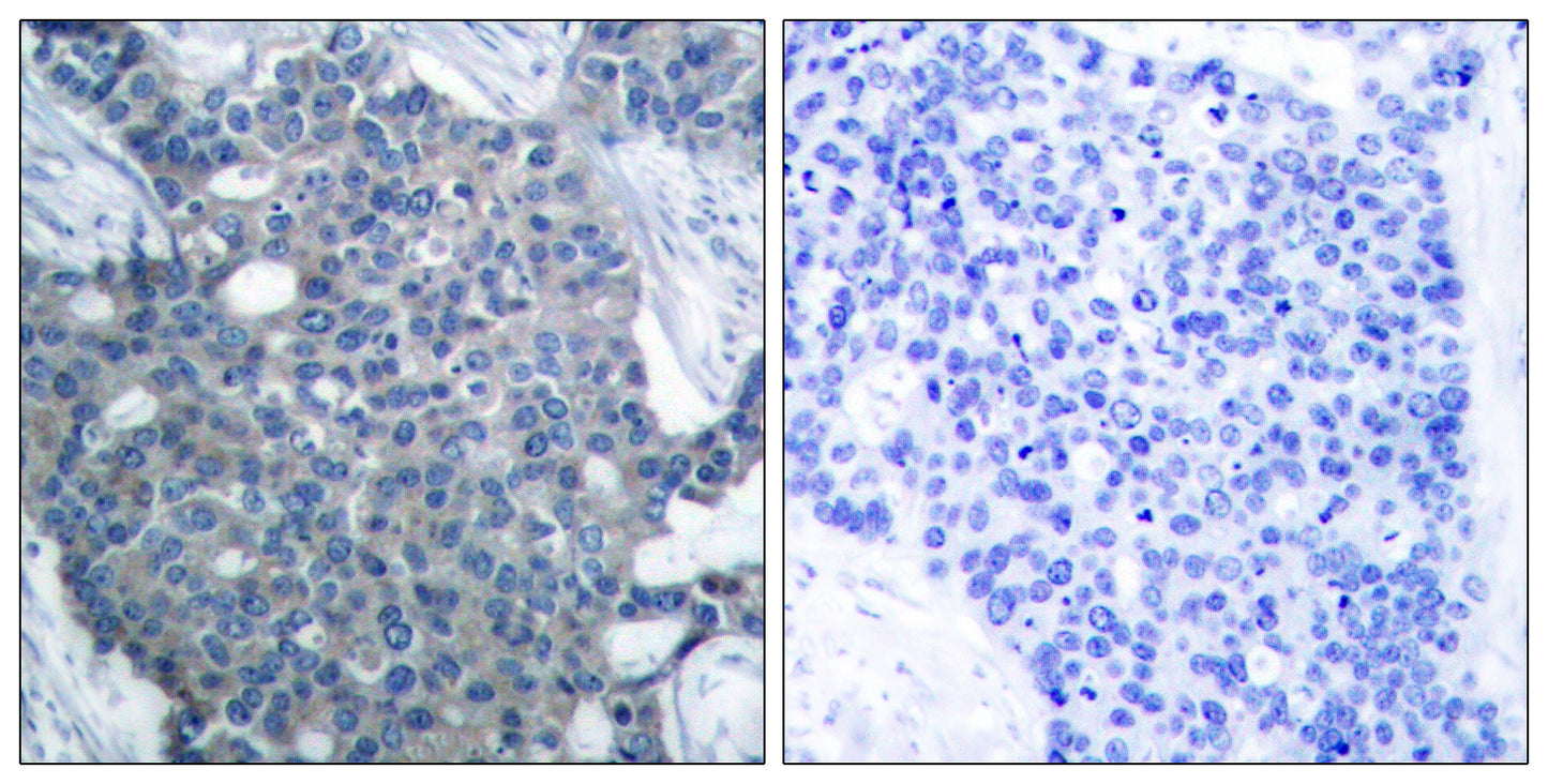 Op18 Rabbit Polyclonal Antibody