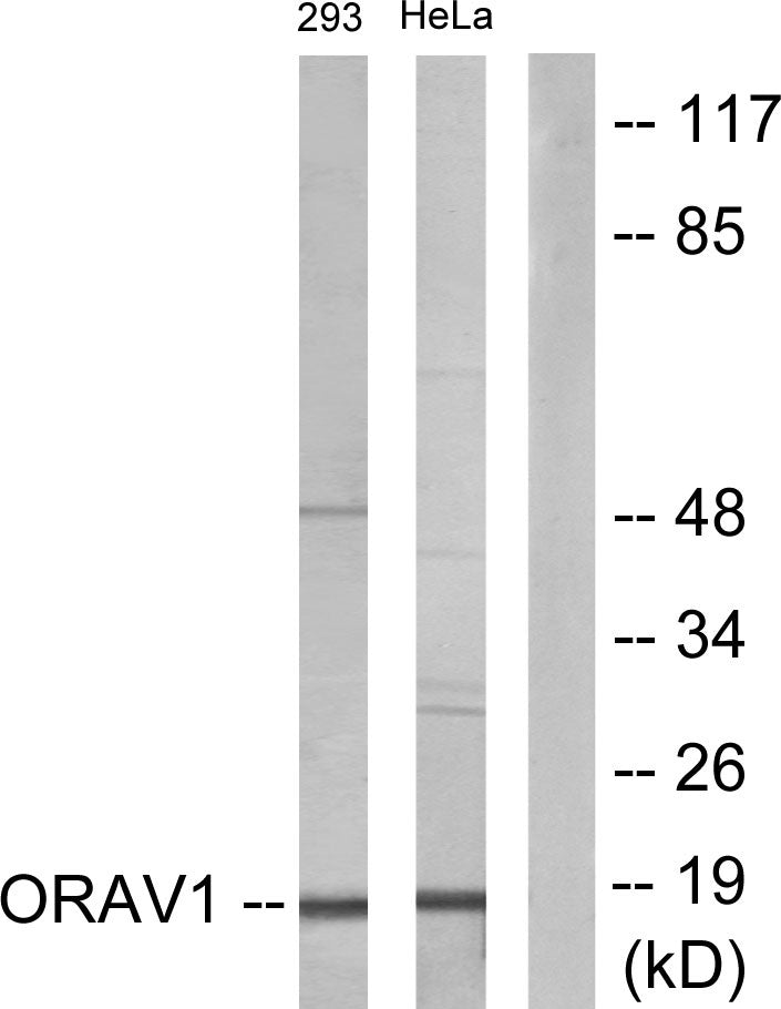 ORAOV1 Rabbit Polyclonal Antibody