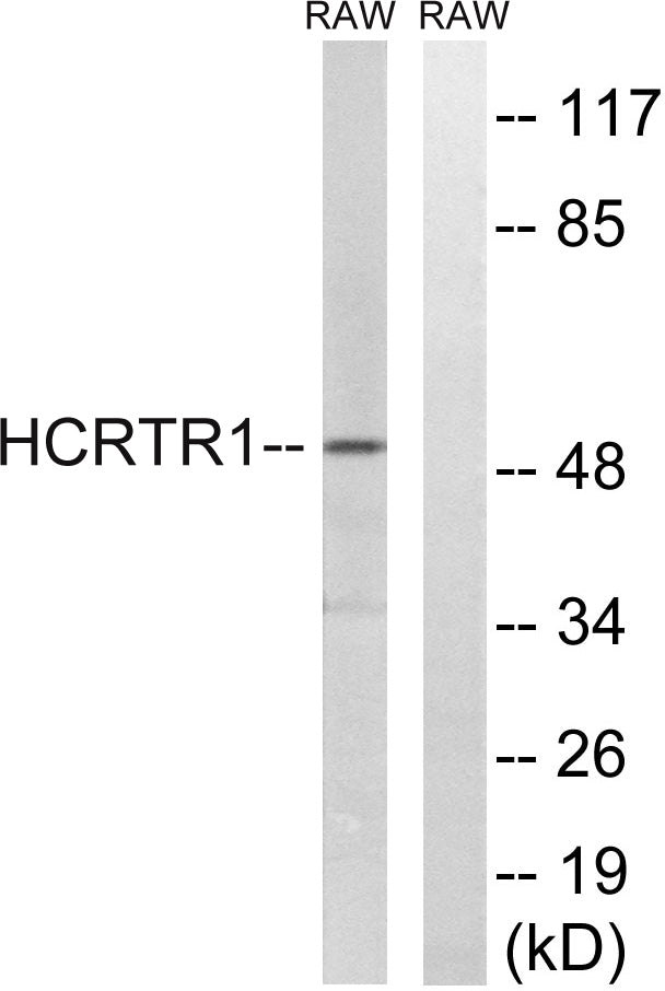 Orexin R-1 Rabbit Polyclonal Antibody