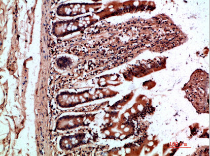 OSM Rabbit Polyclonal Antibody